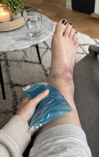 Verletzte Knöchelversorgung im Wohnzimmer
